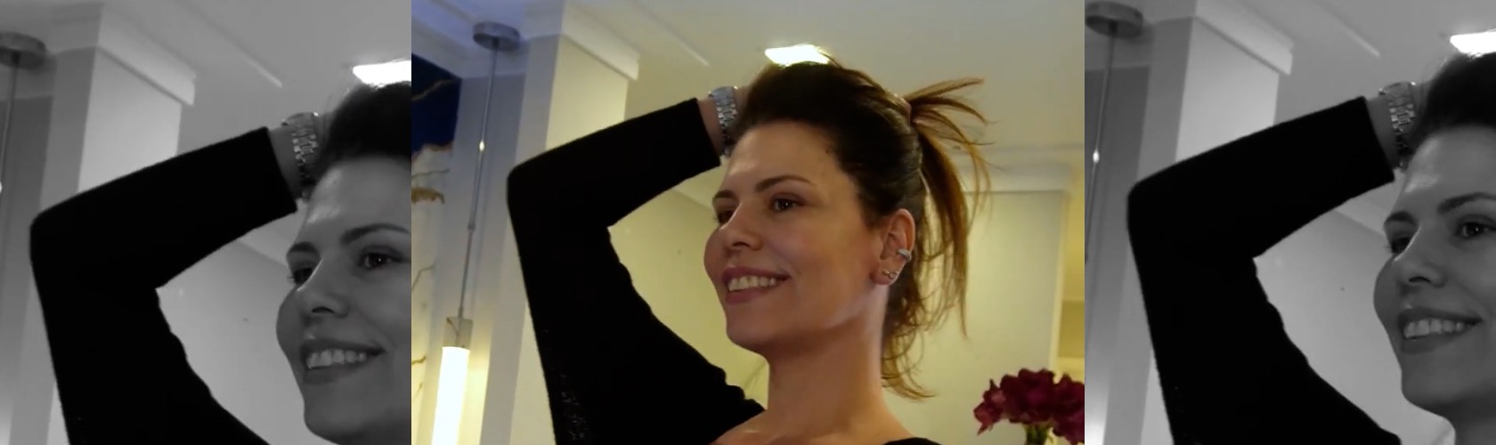 Resultado Microlift E